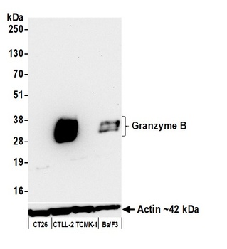 Rabbit anti-Granzyme B Recombinant Monoclonal Antibody