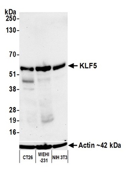 Rabbit anti-KLF5 Recombinant Monoclonal Antibody