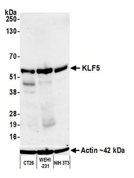 KLF5 Antibody