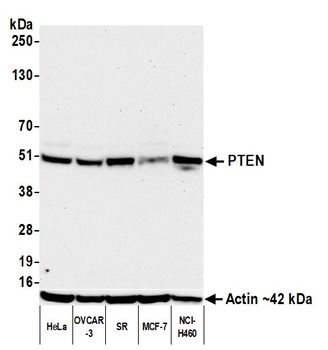 Rabbit anti-PTEN Recombinant Monoclonal Antibody