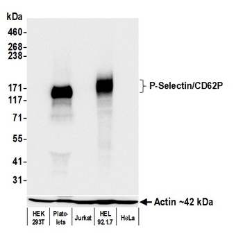 Rabbit anti-P-Selectin/CD62P Recombinant Monoclonal Antibody