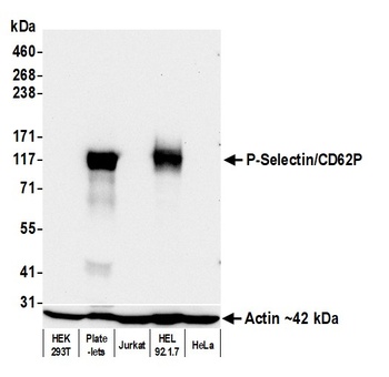 Rabbit anti-P-Selectin/CD62P Recombinant Monoclonal Antibody
