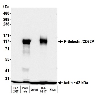 P-Selectin/CD62P Antibody