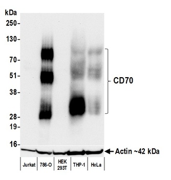 Rabbit anti-CD70 Recombinant Monoclonal Antibody