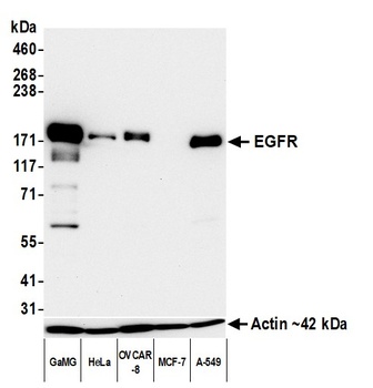 Rabbit anti-EGFR Recombinant Monoclonal Antibody