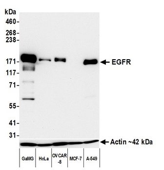 EGFR Antibody