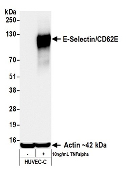 Rabbit anti-E-Selectin/CD62E Recombinant Monoclonal Antibody