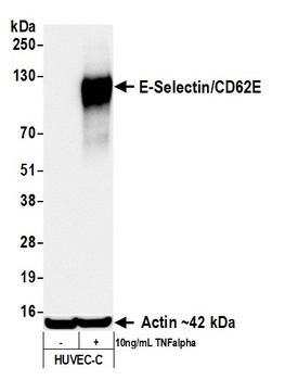 E-Selectin/CD62E Antibody