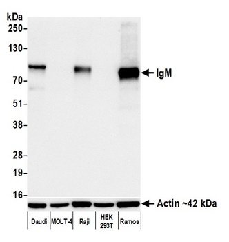 IgM Antibody