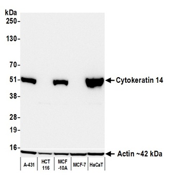 Cytokeratin 14 Antibody