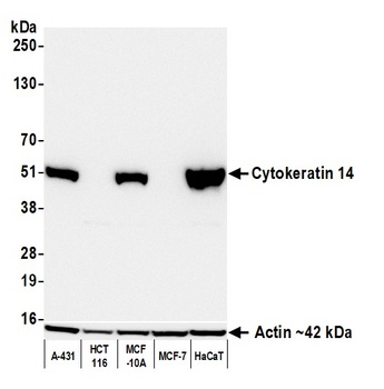 Mouse anti-Cytokeratin 14 Recombinant Monoclonal Antibody