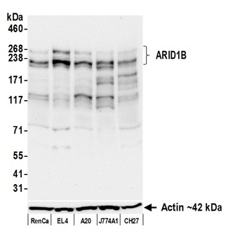 ARID1B Antibody