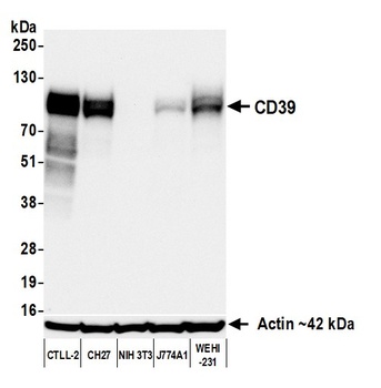 Rabbit anti-CD39 Recombinant Monoclonal Antibody