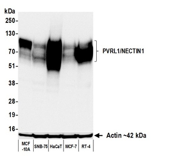 PVRL1/NECTIN1 Antibody