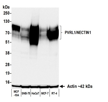 Rabbit anti-PVRL1/NECTIN1 Recombinant Monoclonal Antibody