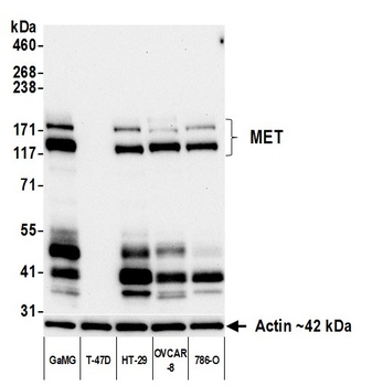 Rabbit anti-Met Recombinant Monoclonal Antibody