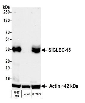 SIGLEC-15 Antibody