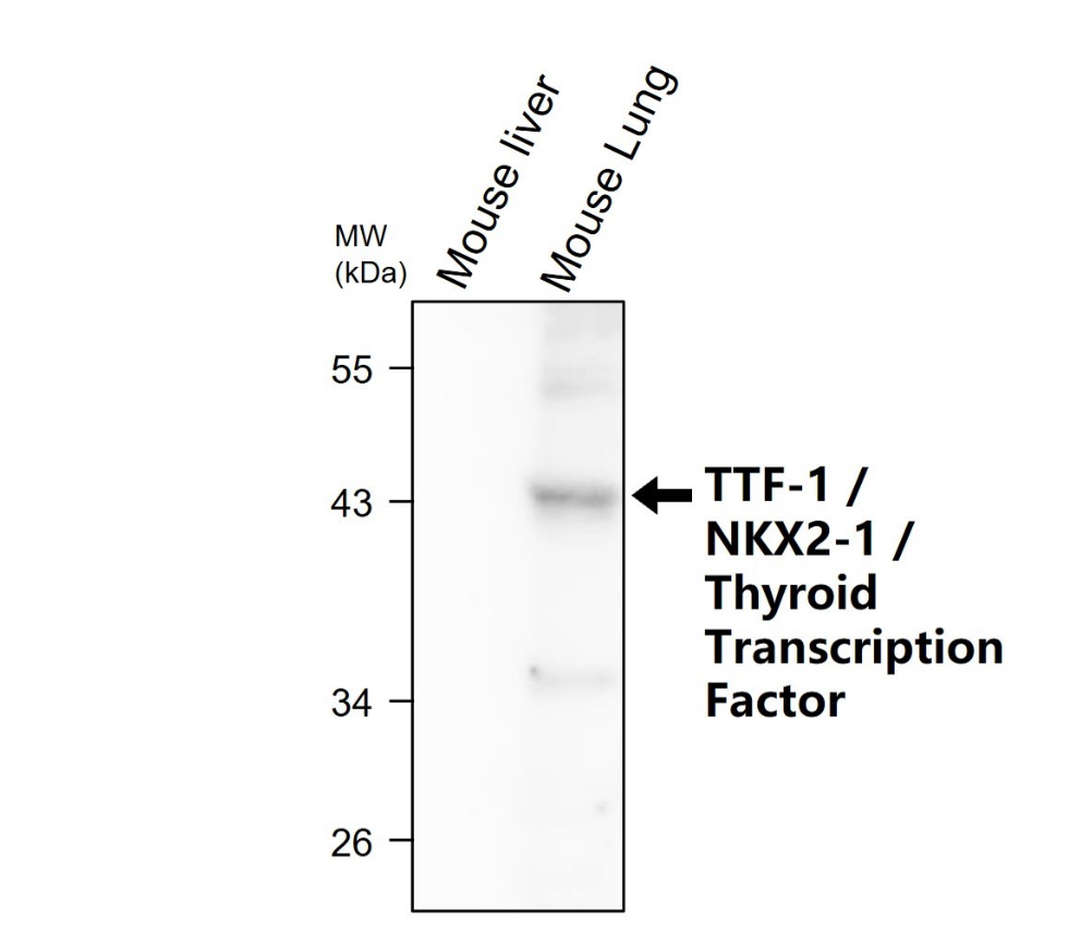 TTF-1 / NKX2-1 / Thyroid Transcription Factor