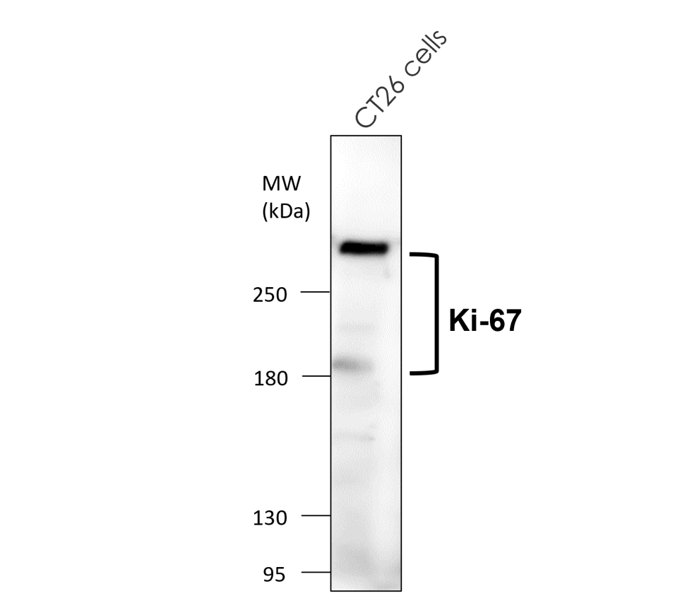 Ki67 [SP6] Rab-monoclonal Antibody