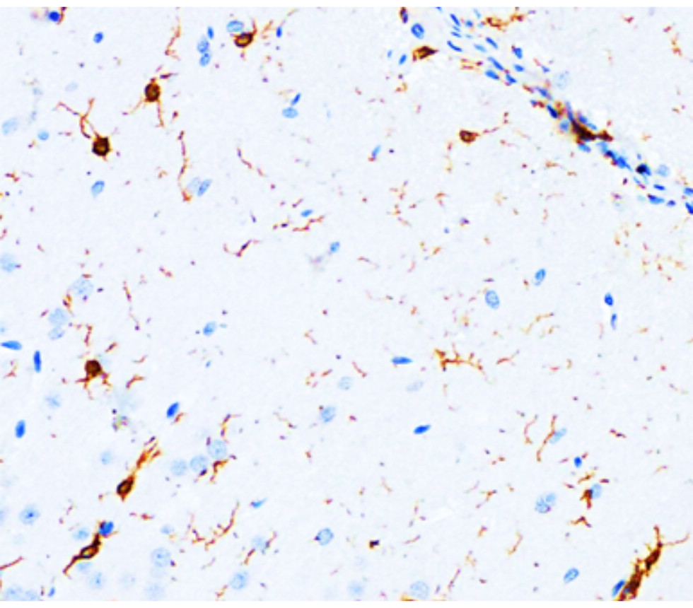 Iba1, monoclonal Antibody