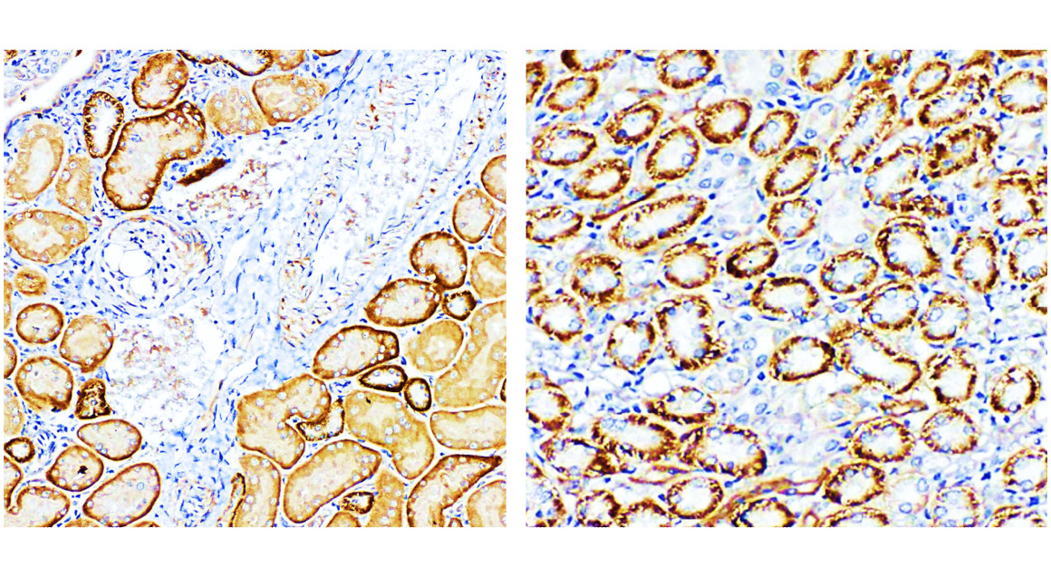 FNDC5/irisin Antibody
