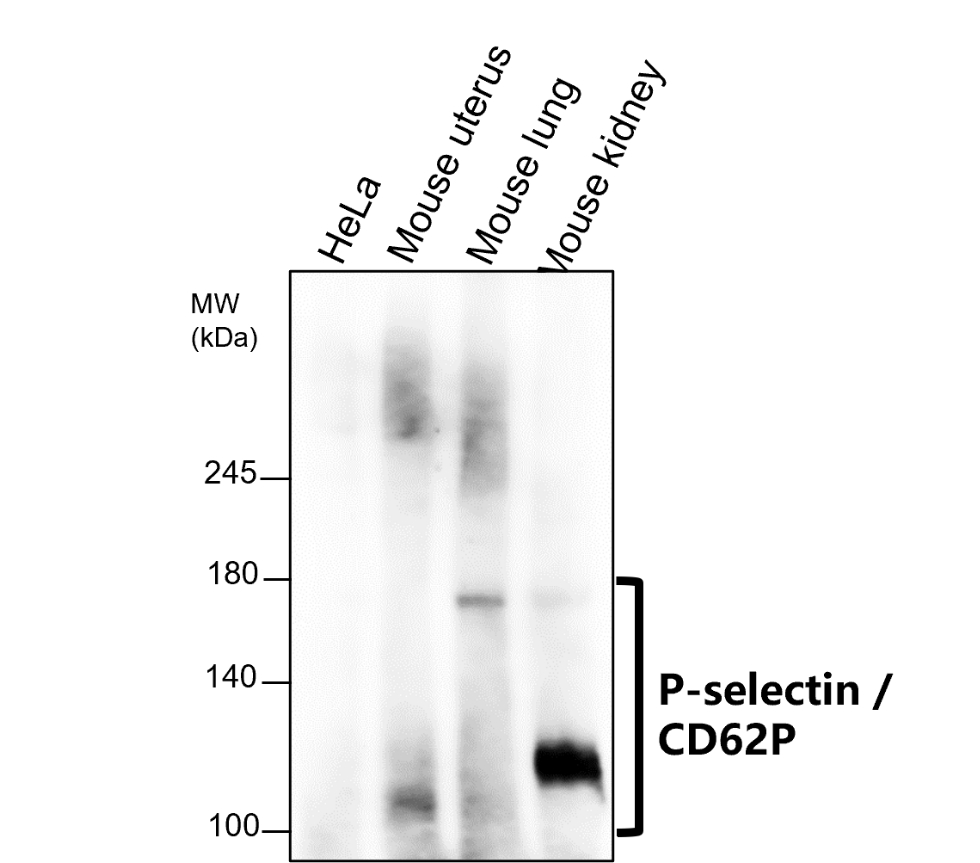 P selectin antibody