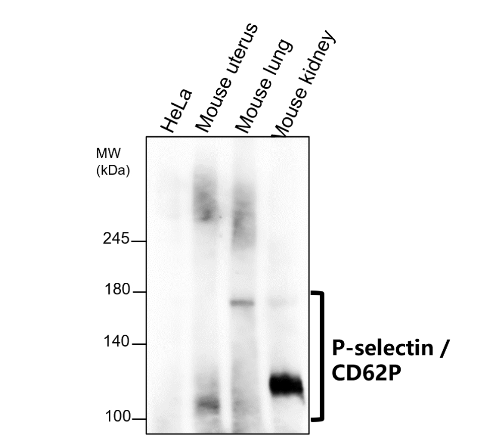 P-selectin | CD62P