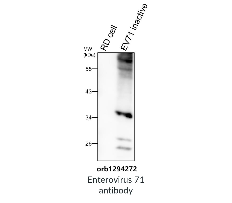 Enterovirus 71 antibody