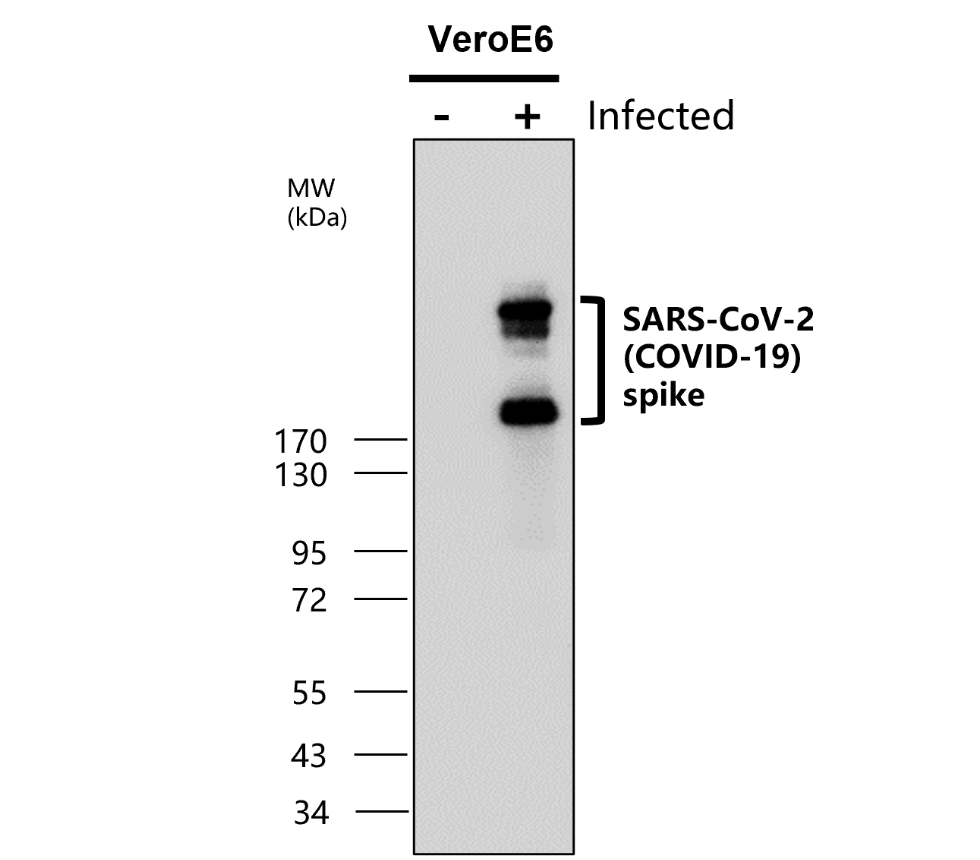 SARS-CoV-2 (COVID-19) Spike