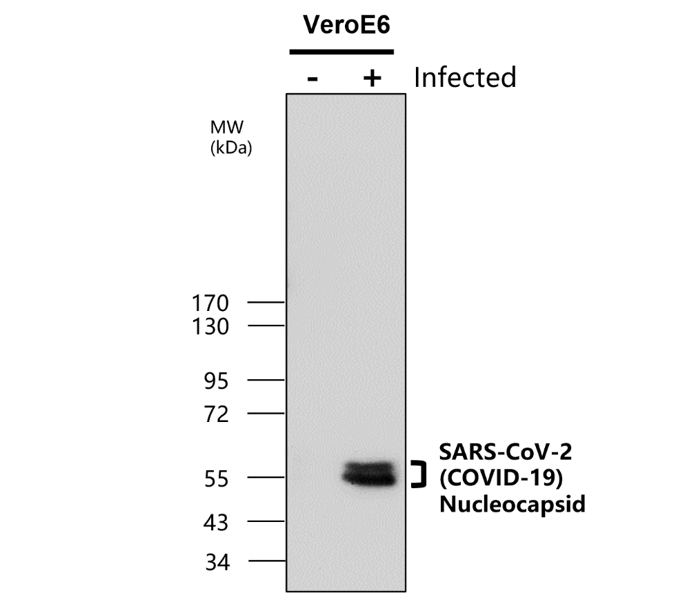 SARS-CoV-2 (COVID-19) nucleocapsid Antibody