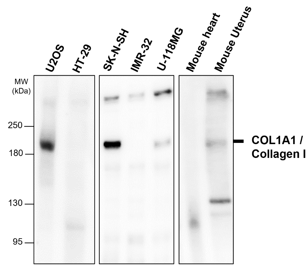 COL1A1 / Collagen I