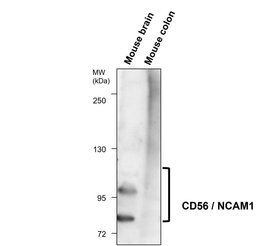 NCAM antibody