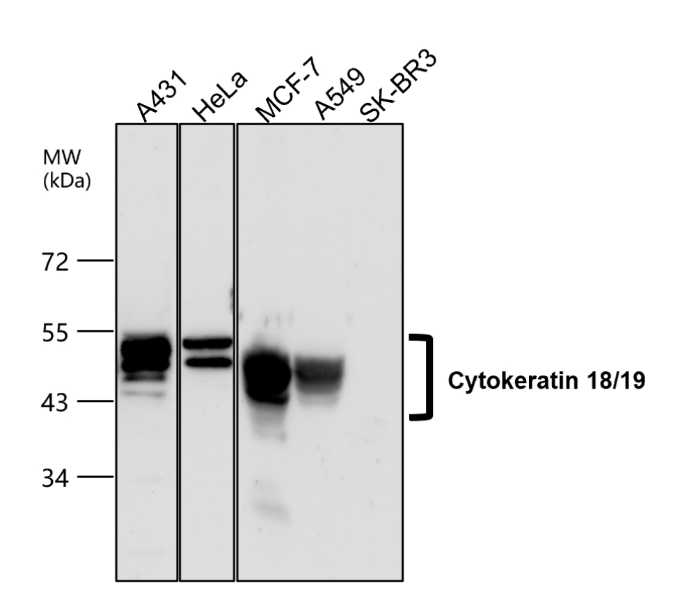 Cytokeratin 18/19, CK18/19