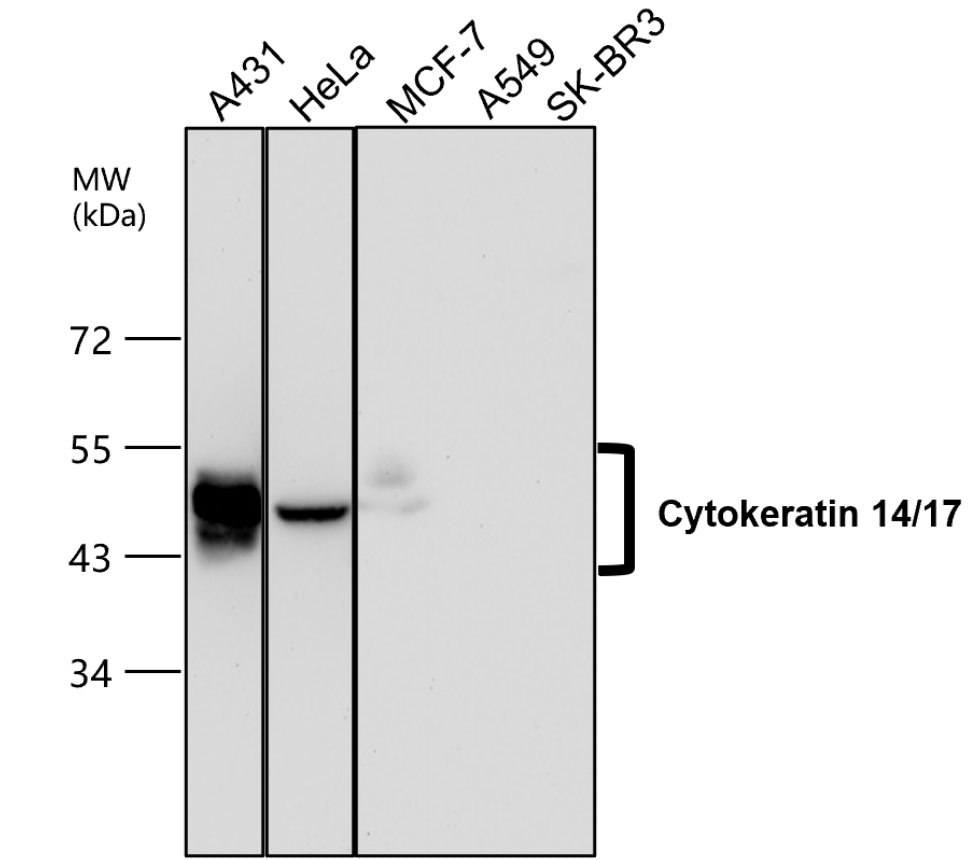 Cytokeratin 14 antibody
