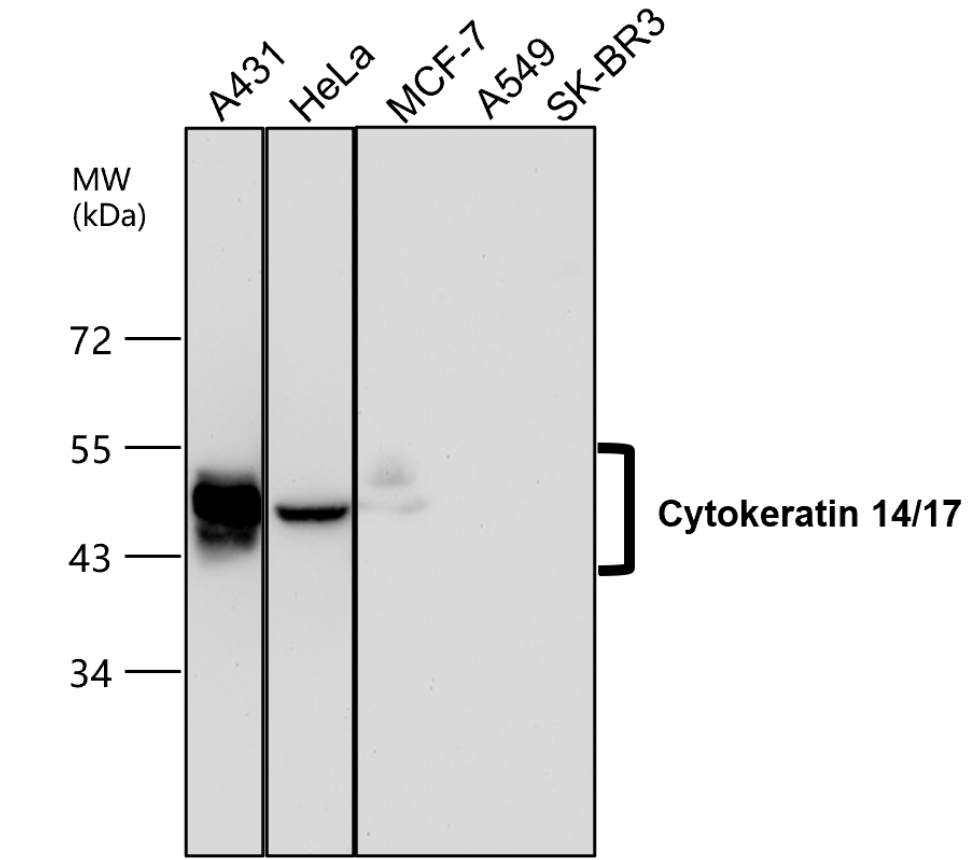 Cytokeratin 14/17, CK14/17