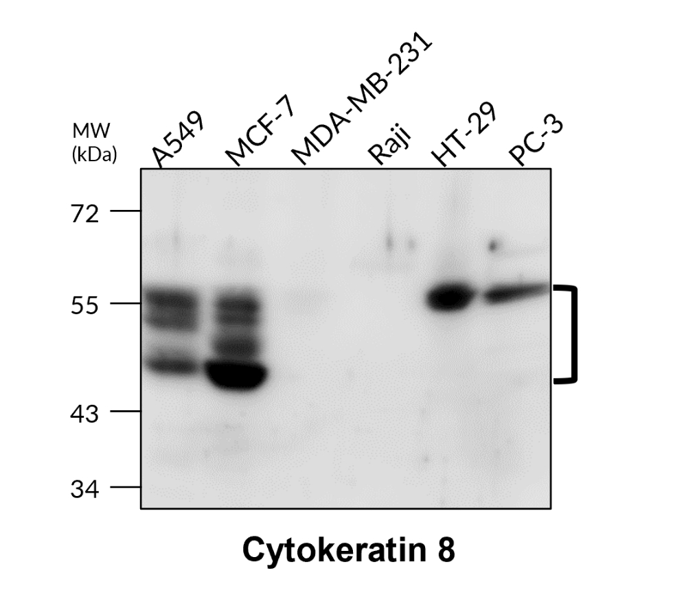 Cytokeratin 8, CK8
