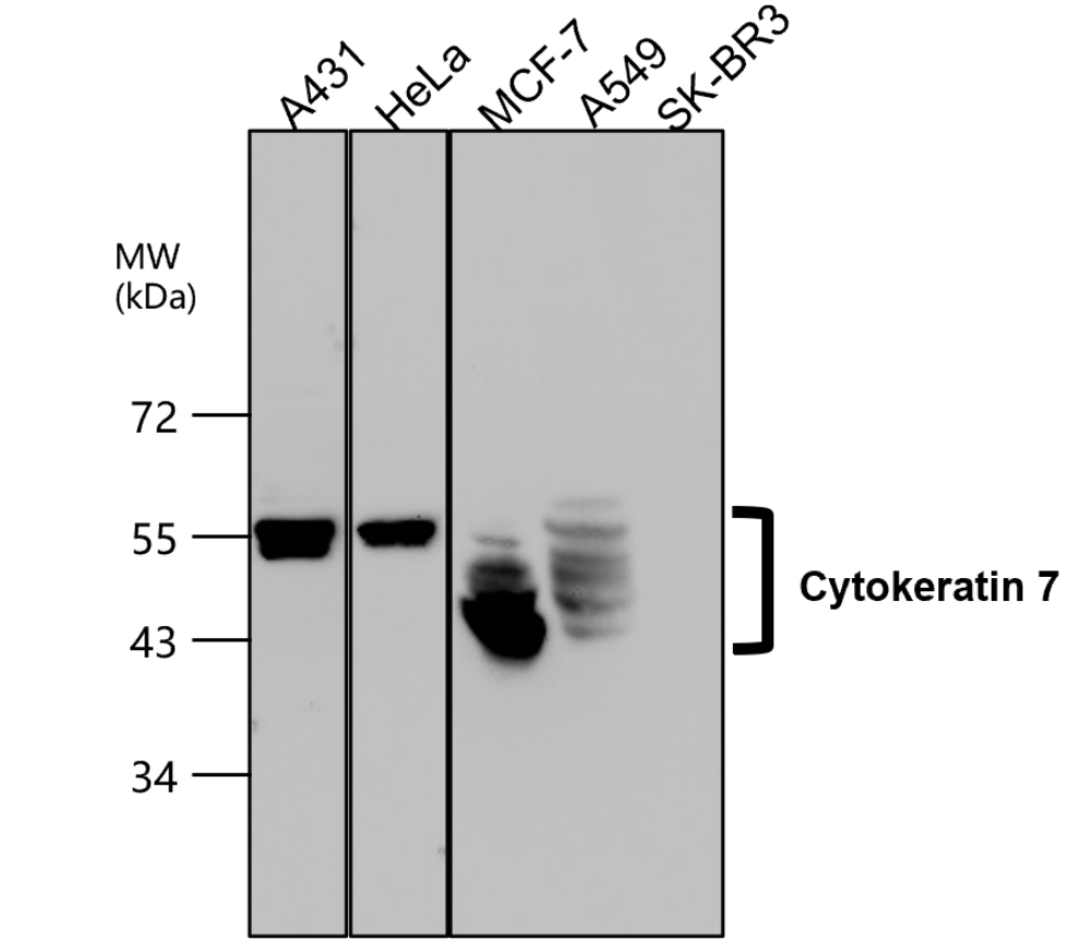 Cytokeratin 7, CK7 Antibody