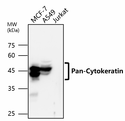 Pan-Cytokeratin, Pan-CK Antibody