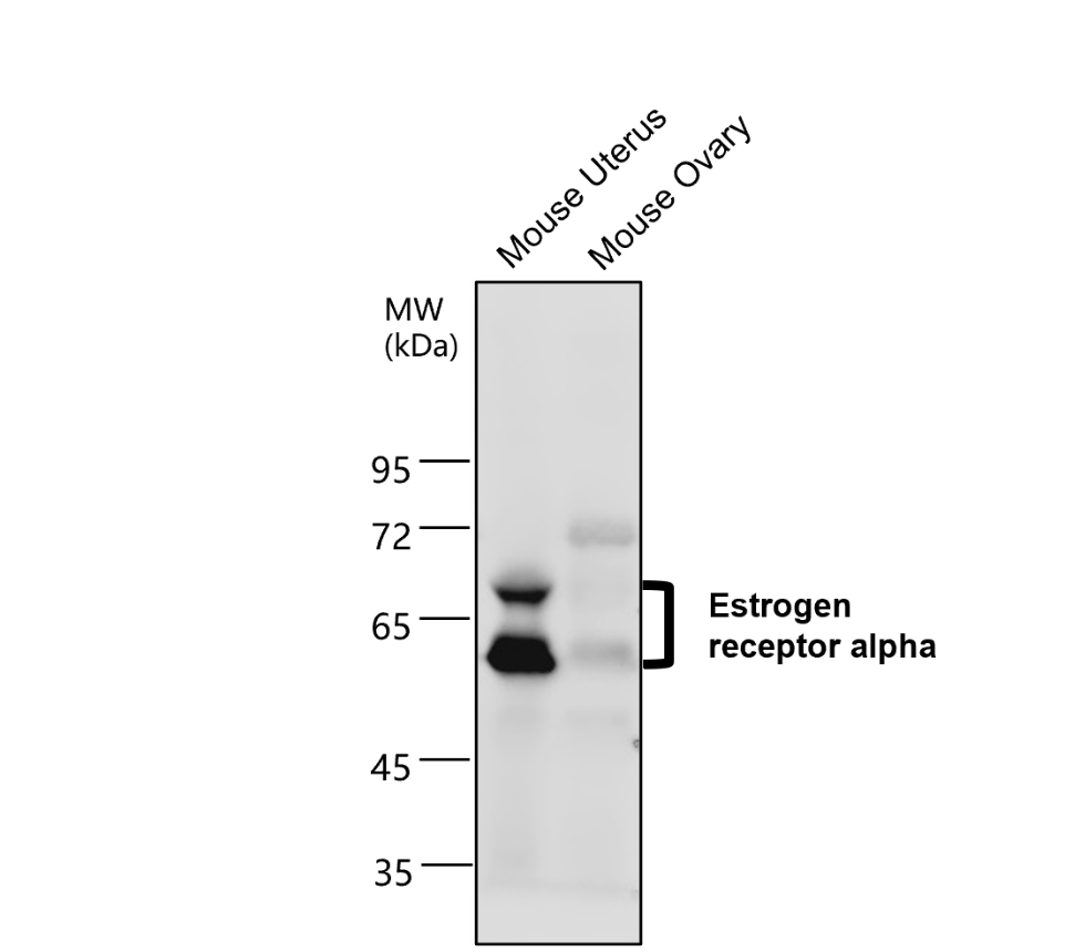 ESR1/Estrogen receptor alpha Antibody