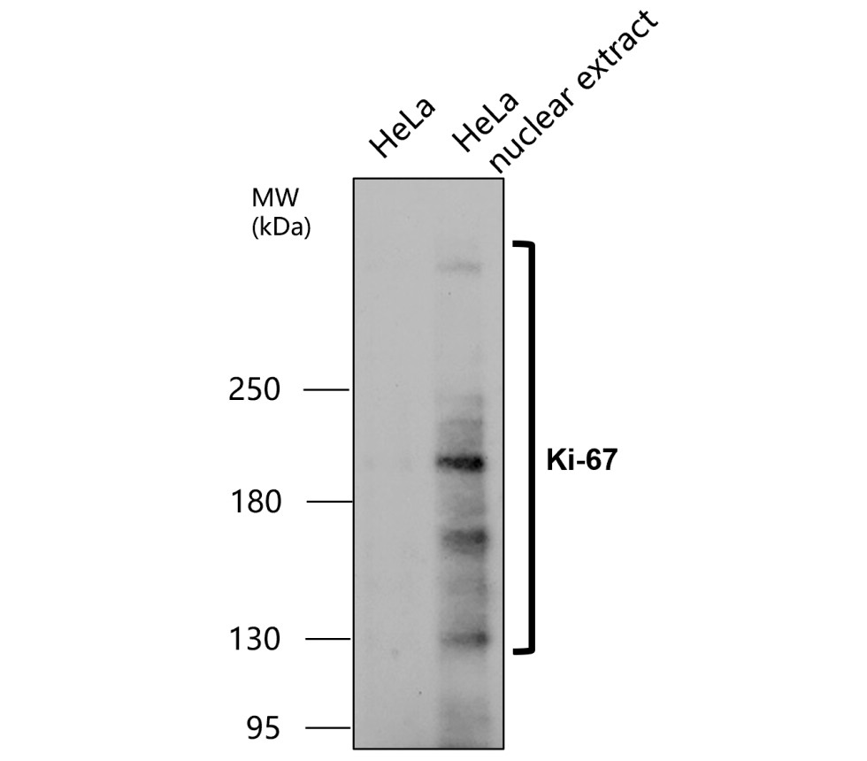KI-67/MKI67 Antibody