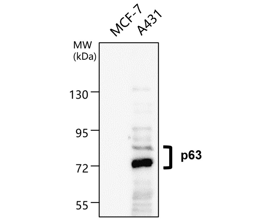 p63 Antibody