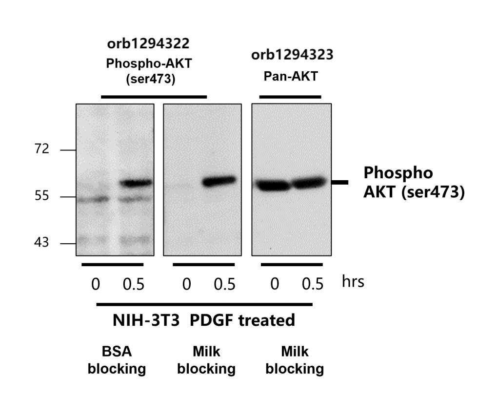 Phospho-AKT (Ser473)