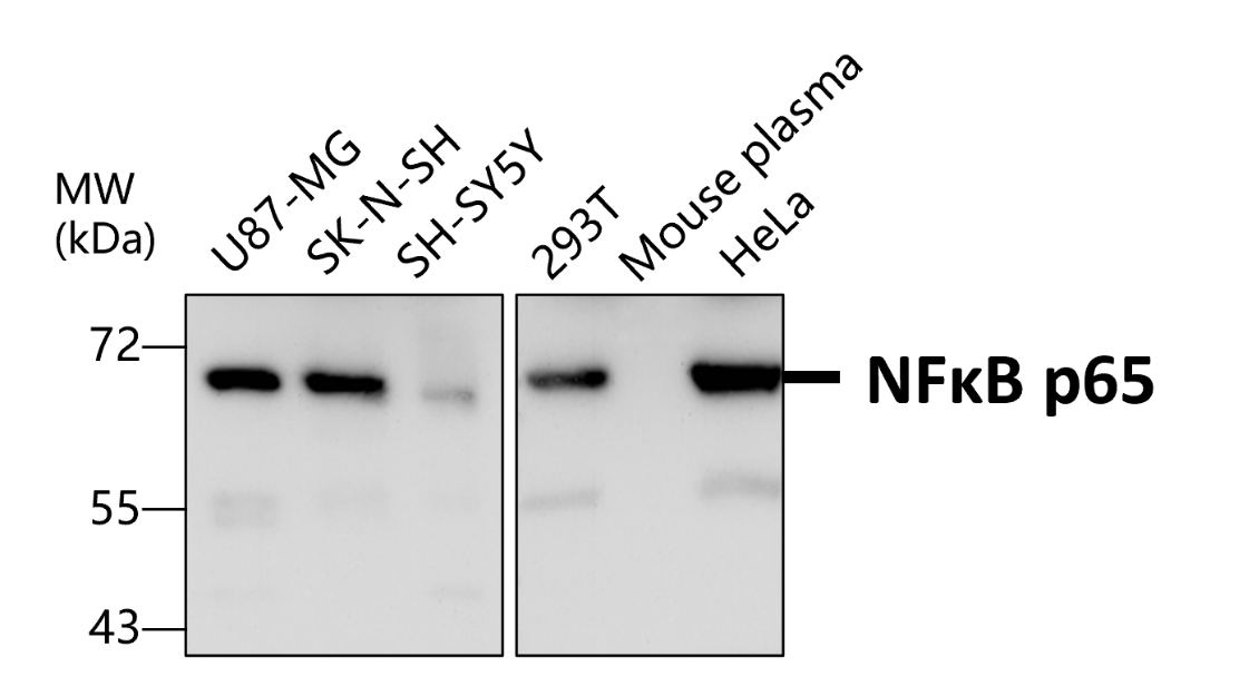 NF-κB p65/RelA Antibody