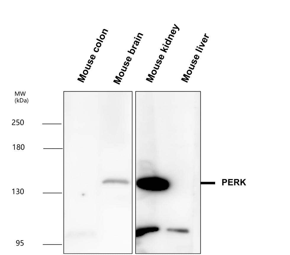 PERK/EIF2AK3 Antibody