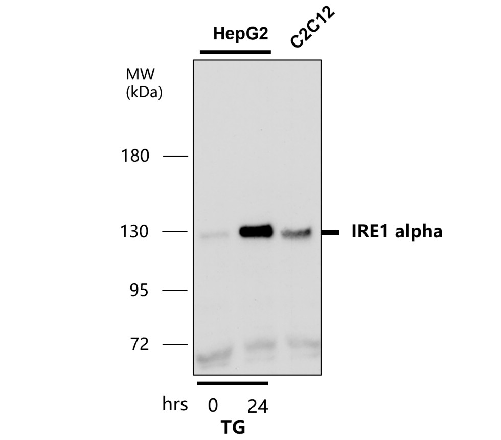 IRE1 alpha antibody