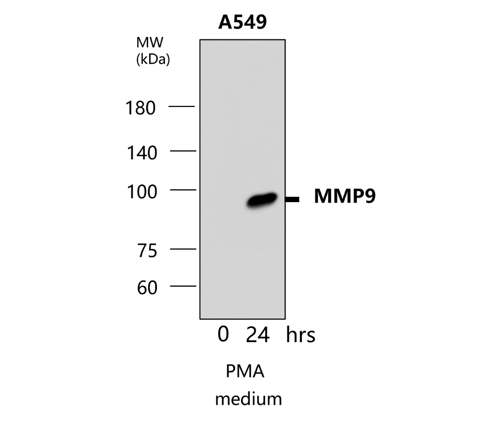 MMP9 Antibody