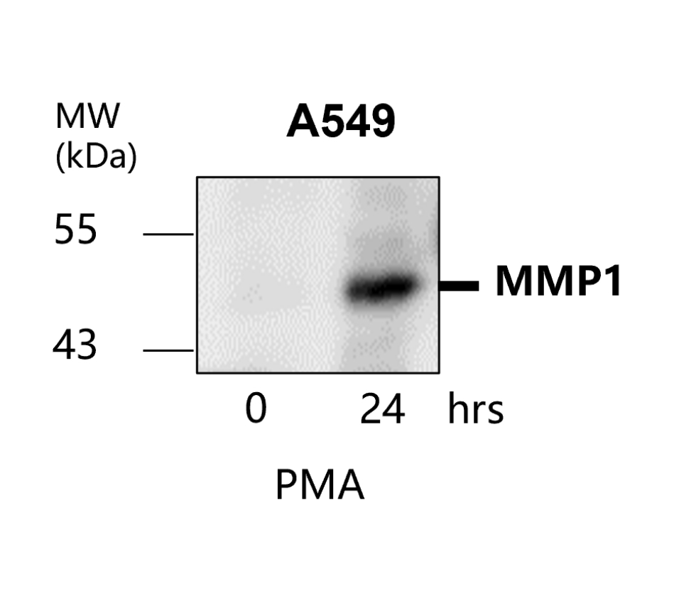 MMP1 Antibody