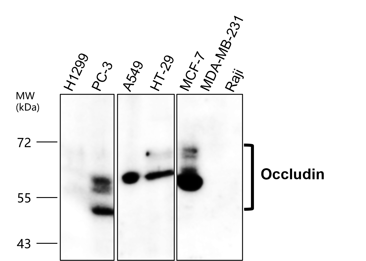 OCLN / occludin