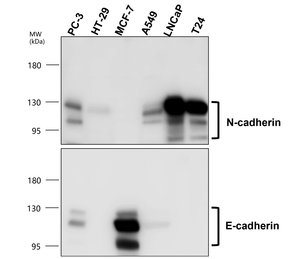 E-cadherin (Intracellular)