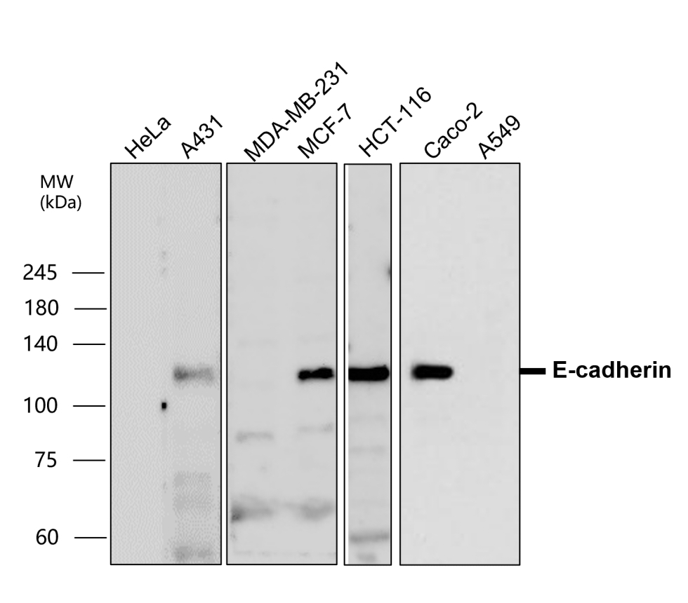 E-cadherin (Extracellular domain) antibody